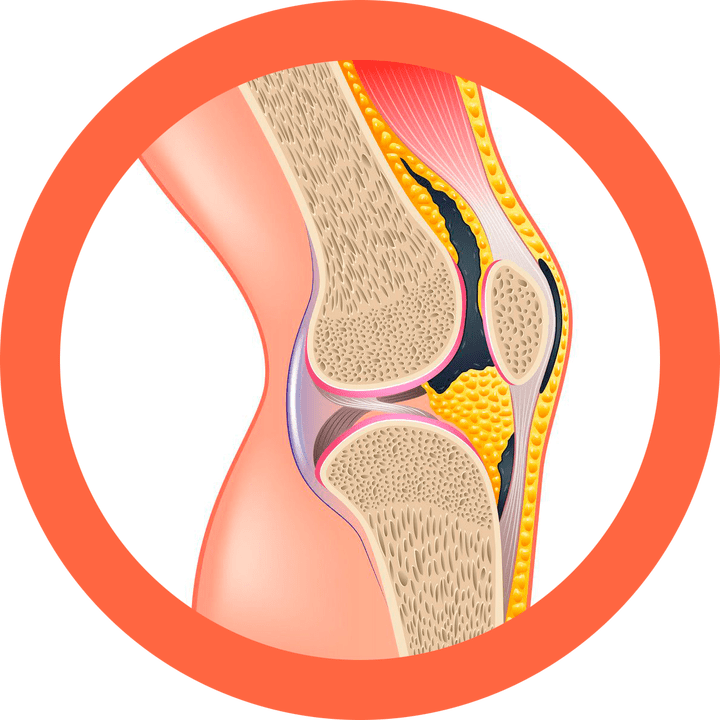 Hondrotene – αποκαθιστά τις αρθρώσεις και τους μύες